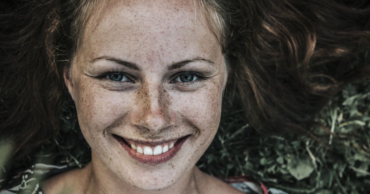 Die Gründe der Pigmentflecke auf der Person und die Hände